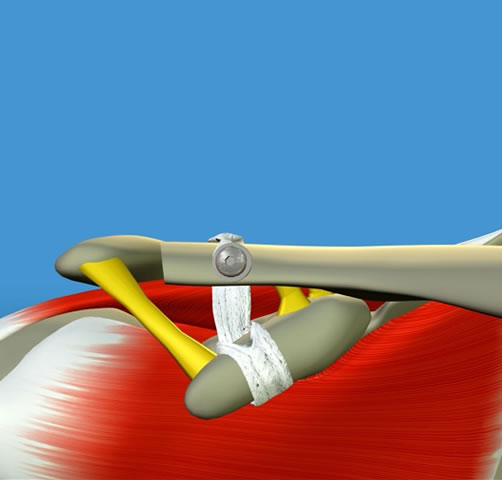 Acromioclavicular Joint Diagram